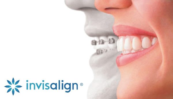 Invisalign, Dentiste à Hawkesbury